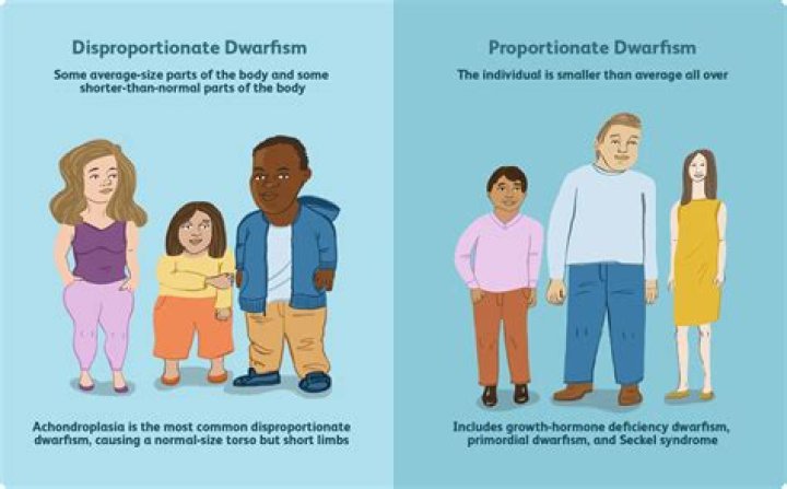 Exploring Dwarfism And The Journey Of A Special Baby