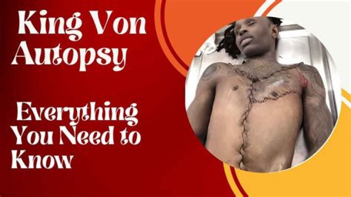 King Von's Autopsy Report Unveils Startling Revelations