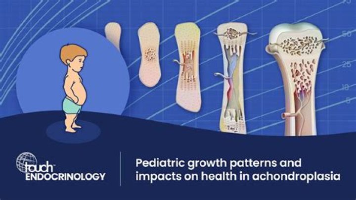 Peter Dinklage's Fascinating Condition: Understanding Achondroplasia